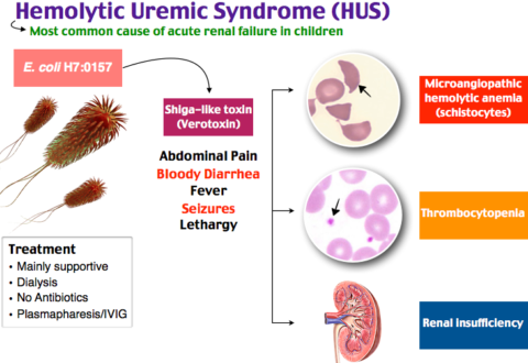 CME: Atypical hemolytic uremic syndrome (aHUS): therapeutic updates and CME: Atypical hemolytic uremic syndrome (aHUS): therapeutic updates and