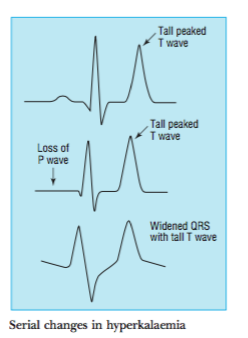 hyperkalemia binders potassium outcome optimal